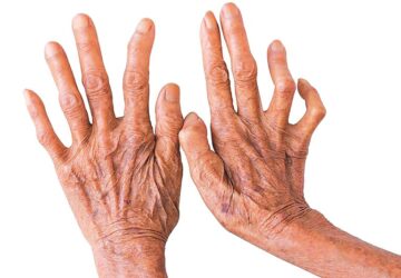 <?php the_title();?>